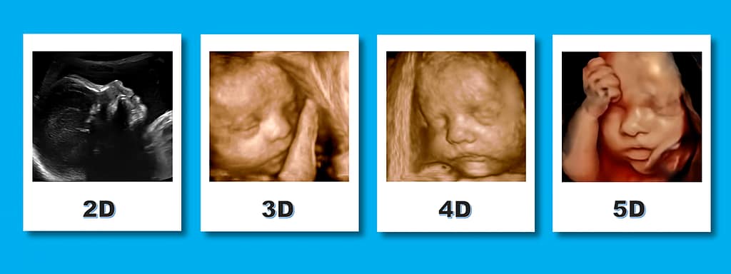 Esquema 2D, 3D, 4D, 5D